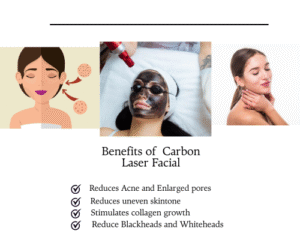 Benefits of Carbon Laser Facial-Dermiscare-porur & kilpauk