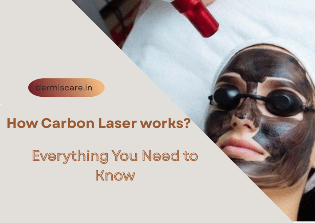 CARBON LASER-skincare blog-dermisare-porur&kilpauk