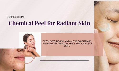 Chemical peel -Dermiscare-porur & Kilpauk