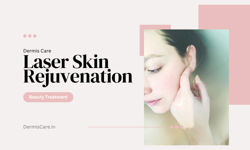 Laser Skin Rejuvenation in Chennai-Dermis Care-porur & Kilpauk