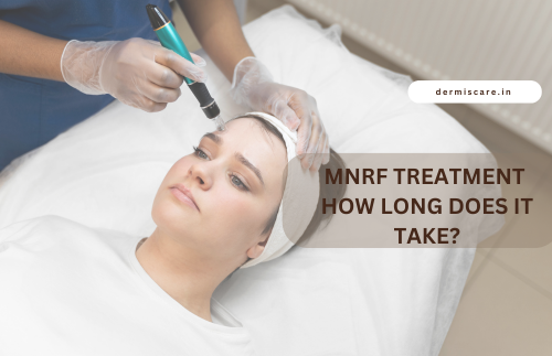 MNRF Treatment -Dermiscare-porur & kilpauk