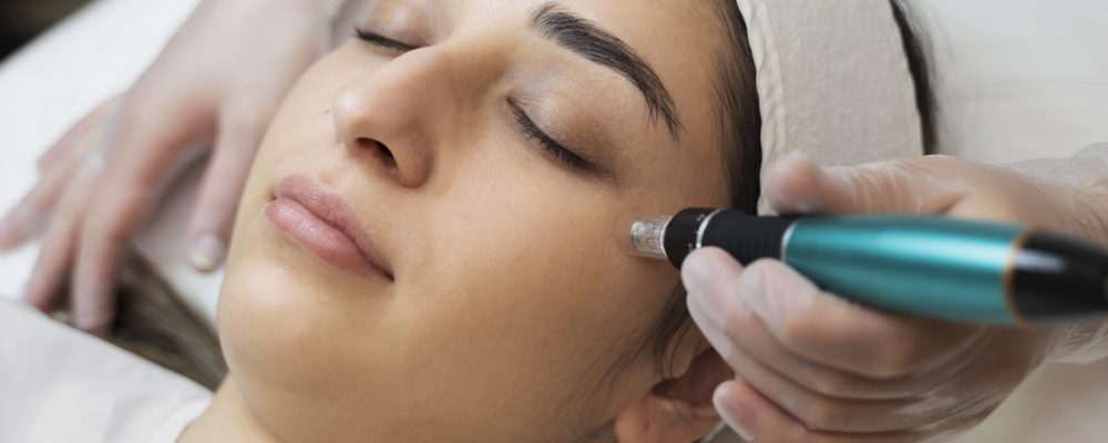 MNRF Treatment for Acne Scars - dermise care