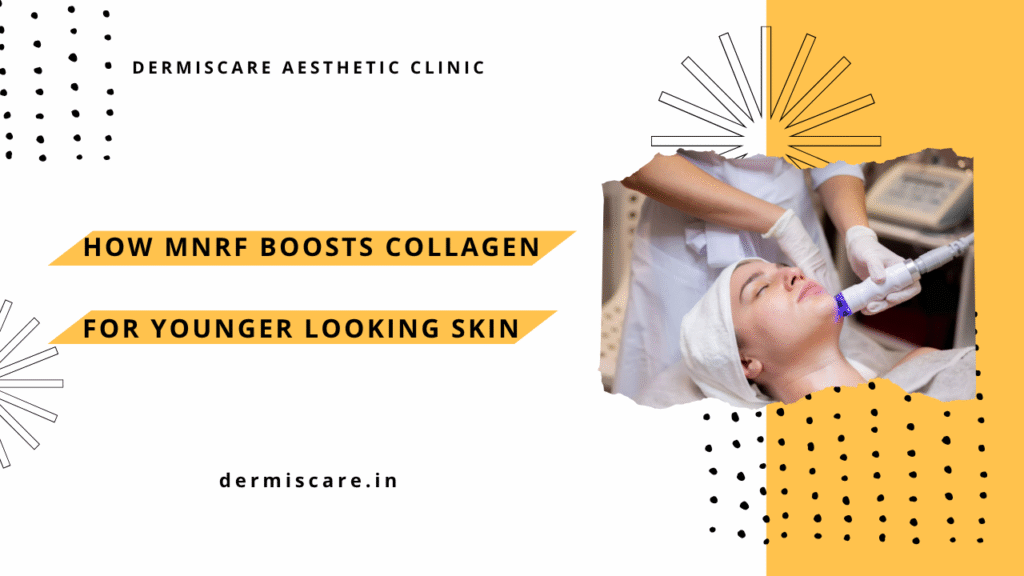 mnrf-treatment-dermiscare at chennai