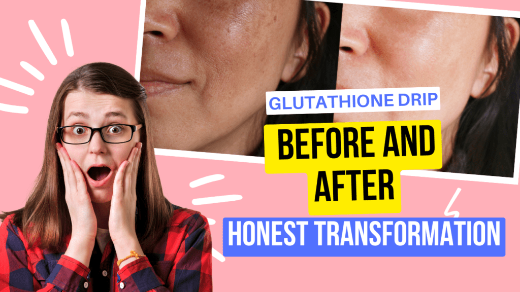 Glutathione Drip Before and After: Honest Transformation