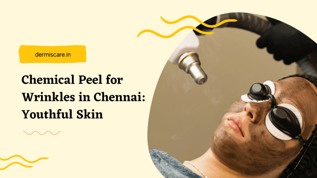 Chemical Peel for Wrinkles in Chennai: Youthful Skin