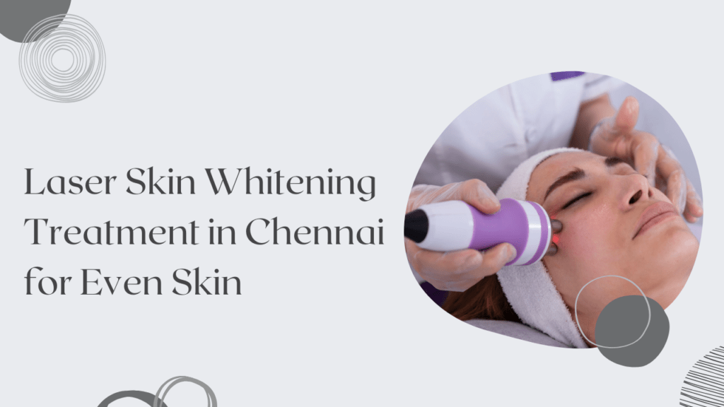 Laser Skin Whitening Treatment in Chennai for Even Skin