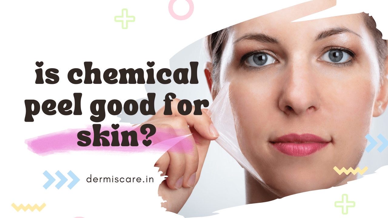 is chemical peel good for skin?
