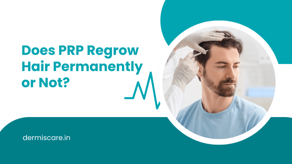 Does PRP Regrow Hair Permanently or Not?
