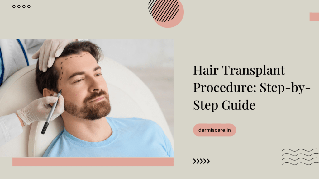 Hair Transplant Procedure: Step-by-Step Guide