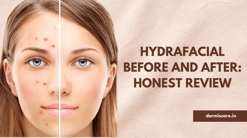 Hydrafacial Before and After: Honest Review