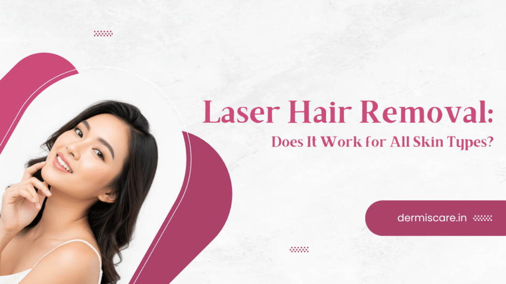 Laser Hair Removal: Does It Work for All Skin Types?
