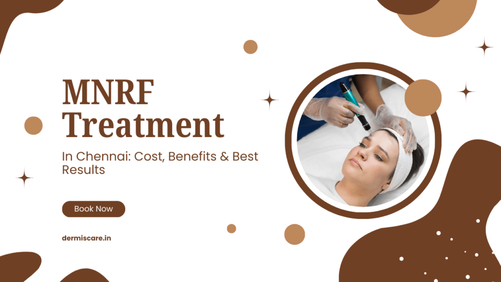 MNRF Treatment in Chennai Cost, Benefits & Best Results
