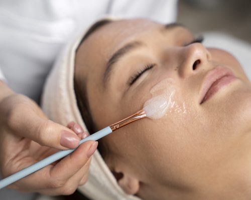 Chemical peels -dermiscare-porur & Kilpauk
