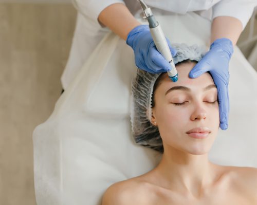 How Long Does MNRF Treatment Take A Complete Guide for You-Dermiscare-porur & kilpauk