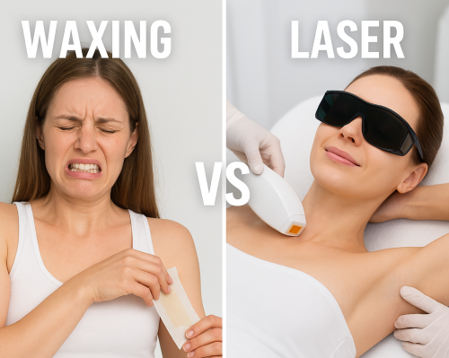 Laser hair reduction vs waxing comparison infographic.