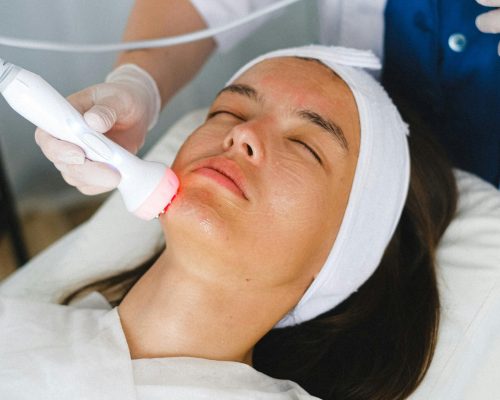 Laser Skin Rejuvenation in Chennai-Dermisare-Porur & Kilpauk