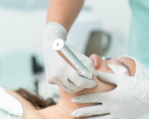 Laser Skin Rejuvenation in chennai-Dermis Care-Porur & Kilpauk