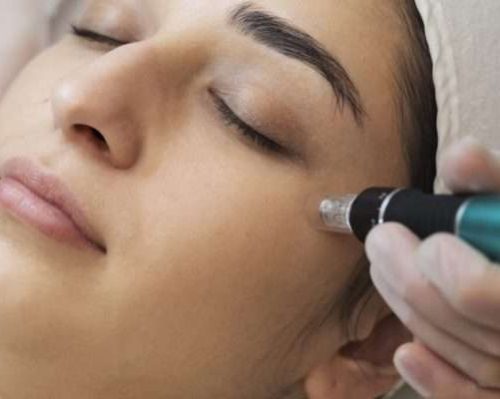 mnrf face treatment in chennai