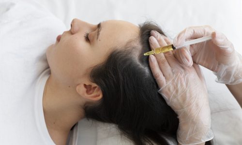 PRP Hair Treament in Chennai-Dermiscare-Porur & Kilpauk PRP Hair Treament in Chennai-Dermiscare-Porur & Kilpauk