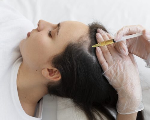 PRP Hair Treament in Chennai-Dermiscare-Porur & Kilpauk