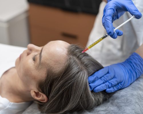 QR678 hair treatment-dermiscare-porur & kilpauk