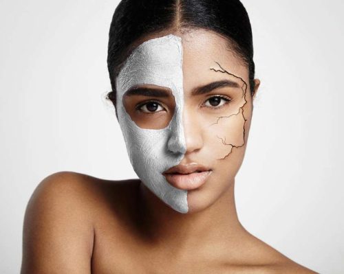 Carbon Laser Treatment Before and After