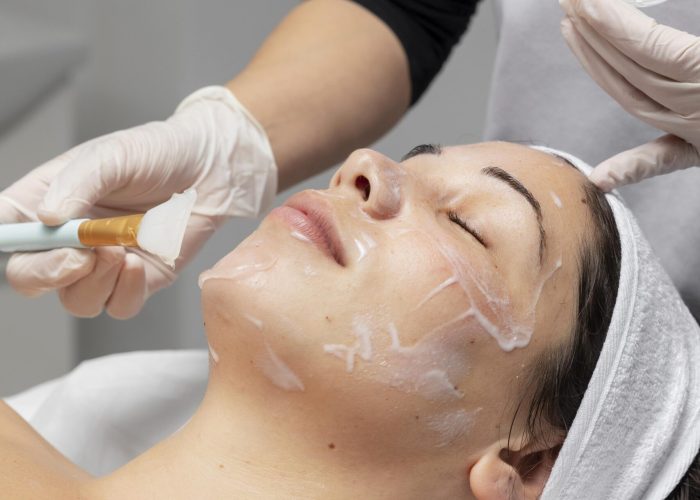 chemical peel treatment_dermiscare