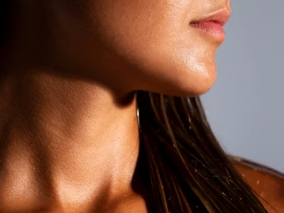 Laser Toning Facial for tan