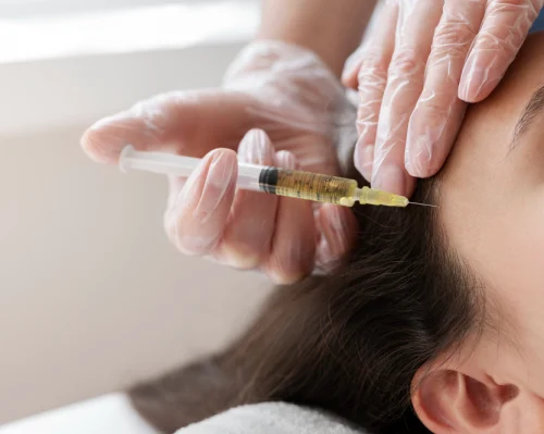 Hair Injections for Hair Growth