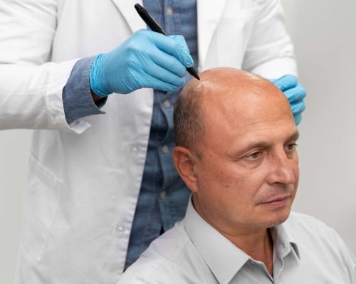 hair transplant clinuc in chennai