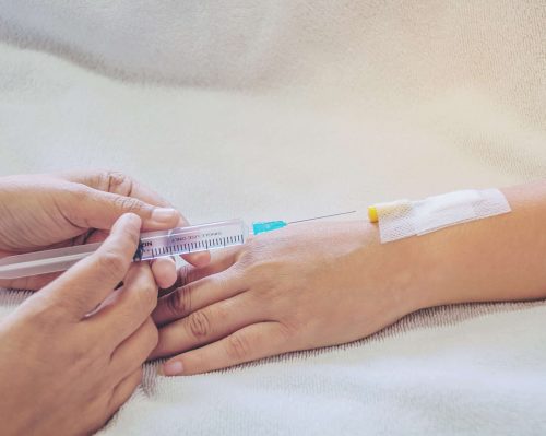 Glutathione Drip Before and After