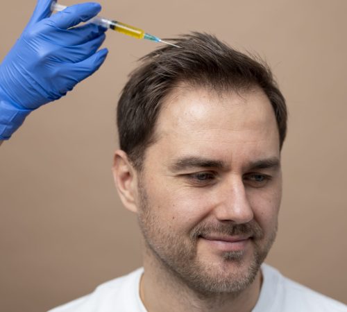 prp-treatment at dermiscare