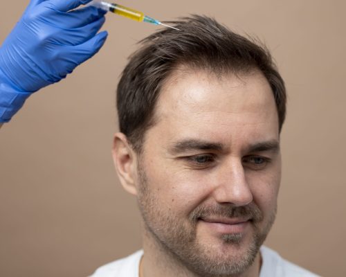 prp-treatment in chennai