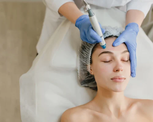 Is Microneedling Treatment Painful? Before You Try It