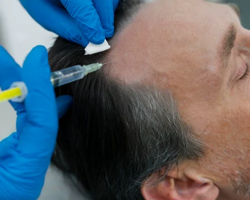 QR678 Hair Treatment in Chennai