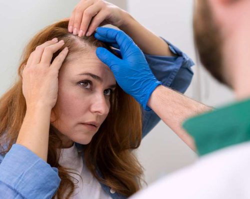 women hair transplant in chennai